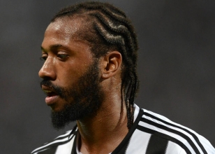 Fernandes PATLADI! �ok a��r!..