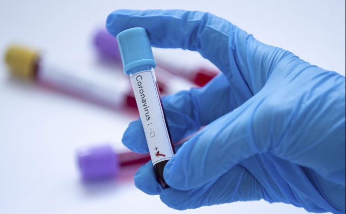 Premier Lig'de bir ma� Kovid-19 nedeniyle ertelendi