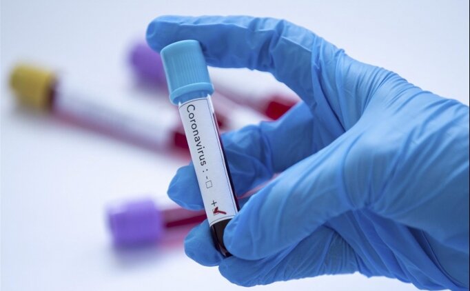 Ke�i�reng�c�'nde bir futbolcu pozitif!