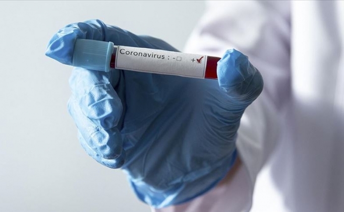 Kovid-19 nedeniyle �lenlerin say�s� d�nya genelinde 30 bini a�t�