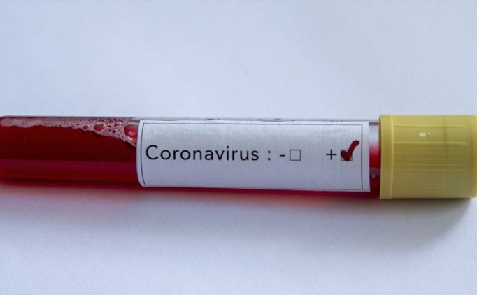 Rusya: 'Koronavir�s� yenecek ilac� bulduk'