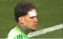 Kayseri'de Ederson'a yabanc� madde!