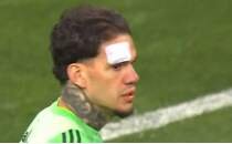 Fenerbah�e'den Ederson'a yabanc� madde i�in a��klama